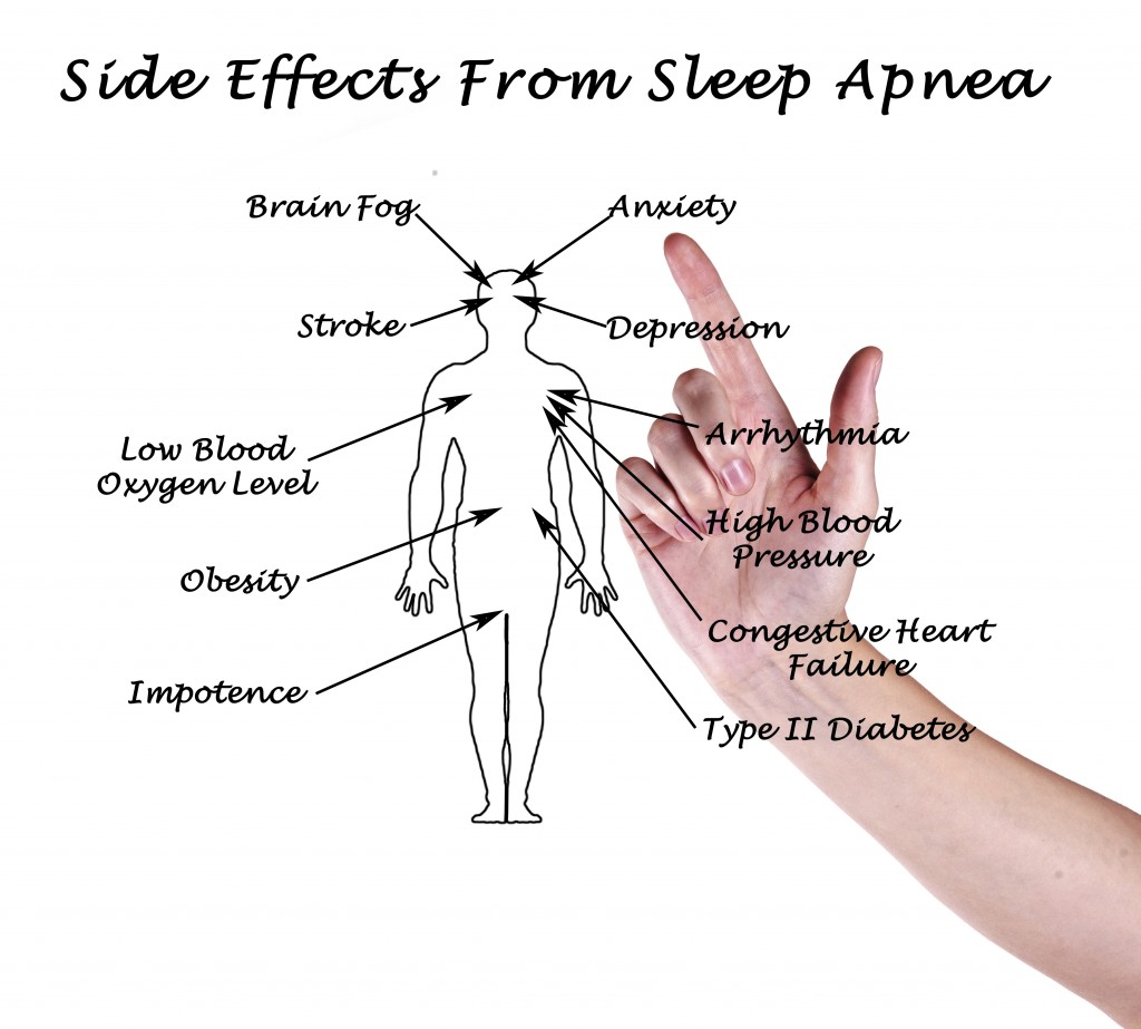 Sleepapneasymptoms