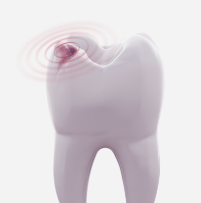 Houston Teeth Cleaning | Book Greenspoint Dental Cleaning Team - Greenspoint Dental – Houston Dentist