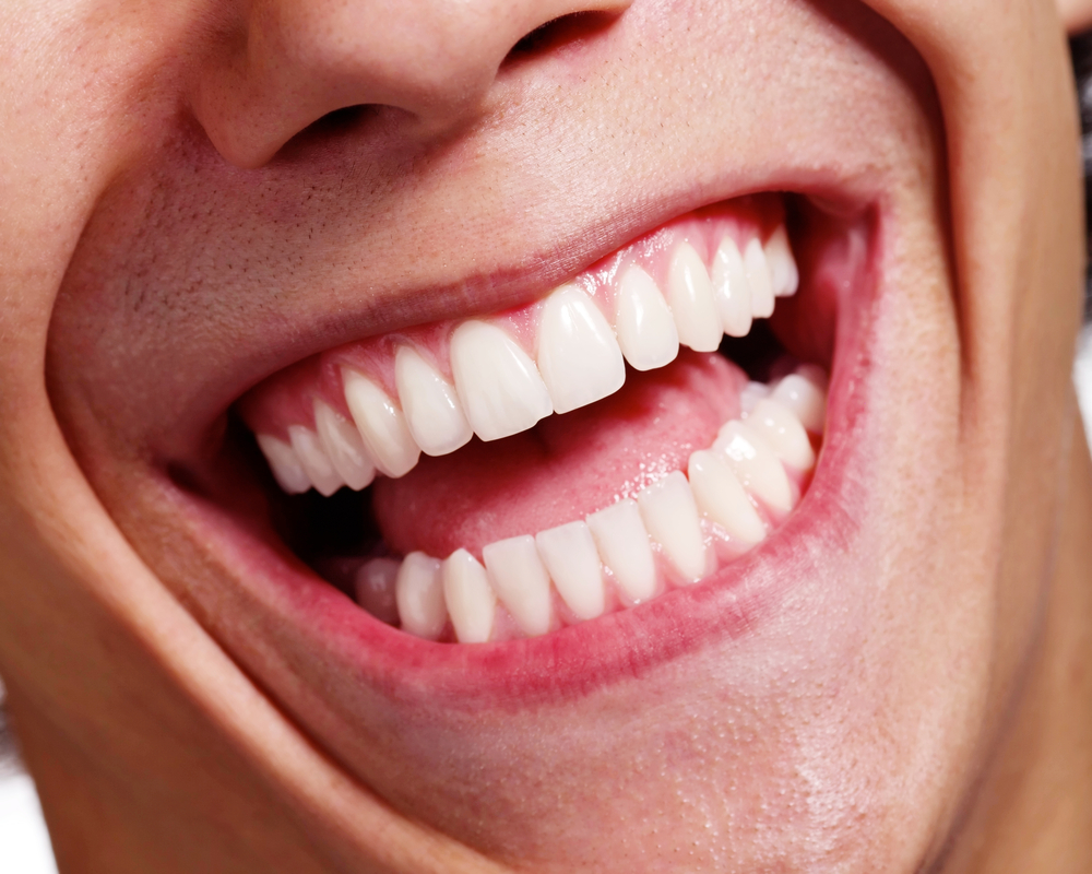 Closeup of mouth, man laughing with beautiful white teeth