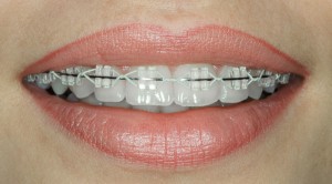 houston orthodontic specialists