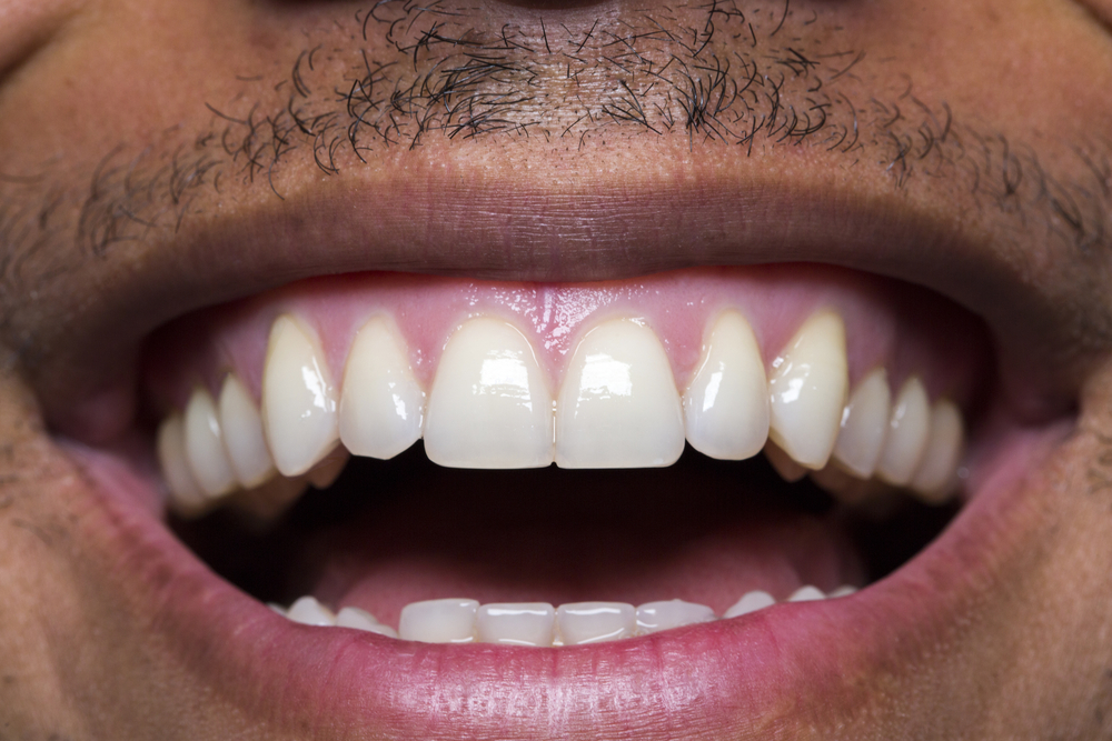 Close up of man's health, straight white teeth