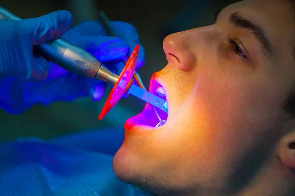 Dentist using dental curing light inside man's mouth