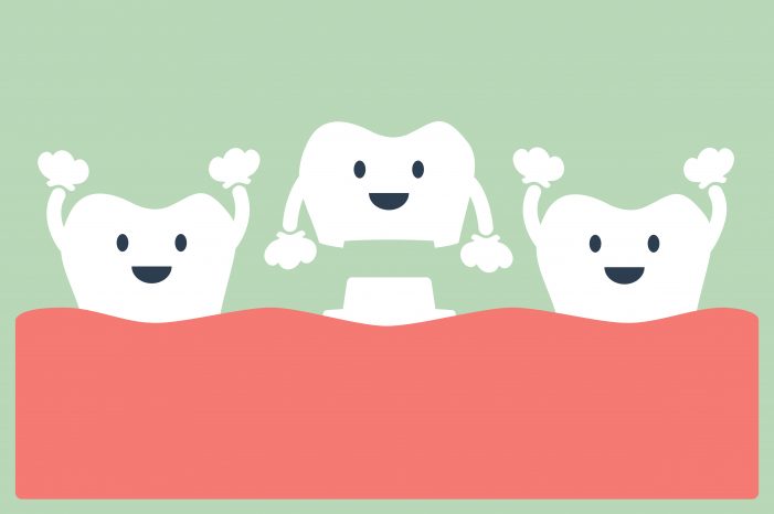 cartoon showing all-on-4 dental implants