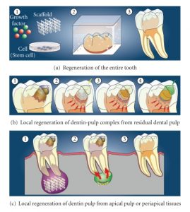 Dental Stem Cell Therapy