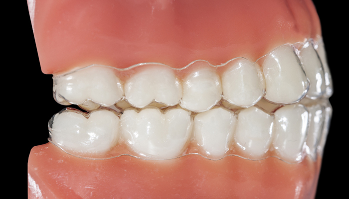 Occlusion, Understanding Your Bite: The Good, The Bad, and The Ugly ...