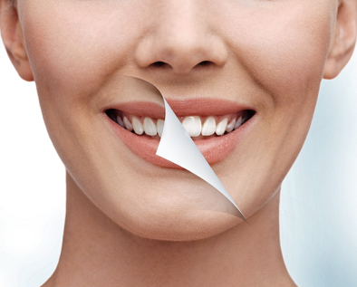 Cosmetic Dentistry Services in Houston