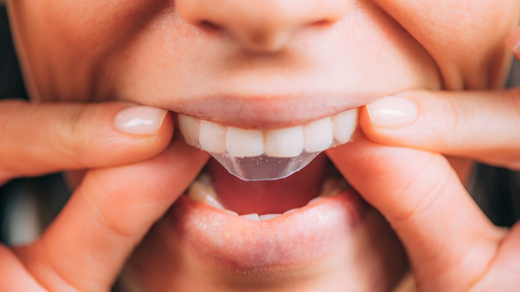 closeup of woman applying at-home whitening strips