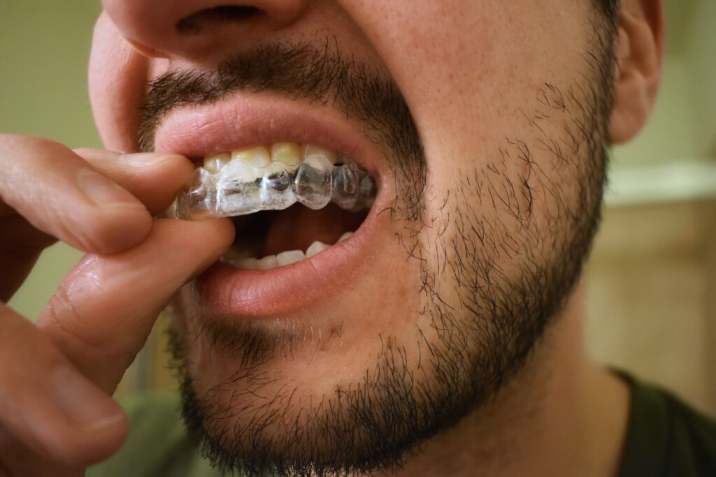 close up of man putting on Invisalign