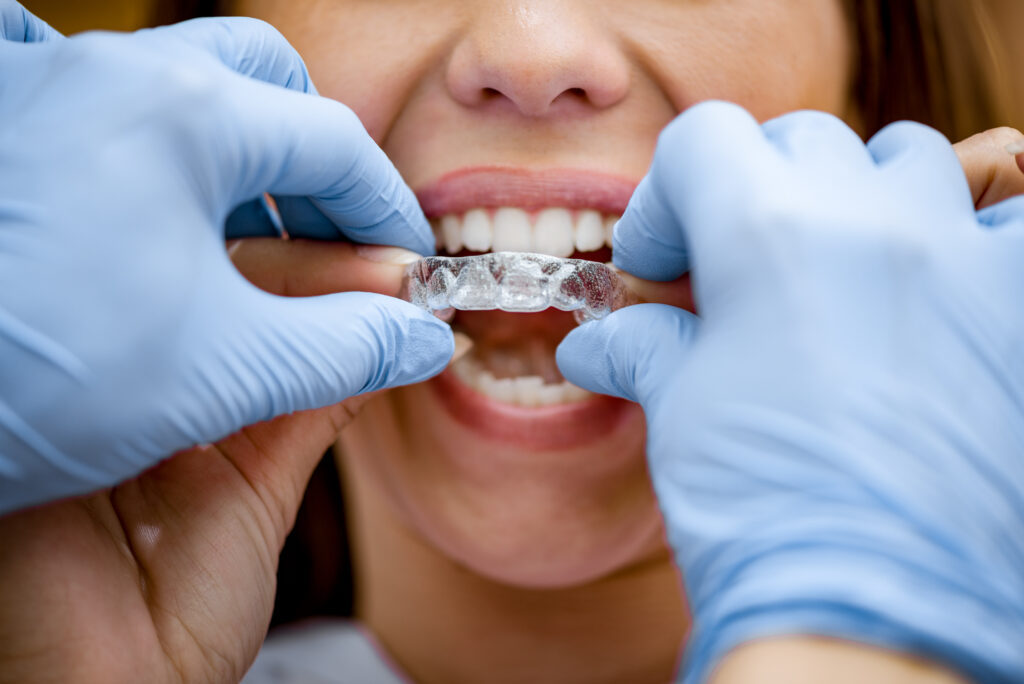 close up of dentist putting retainer on patient