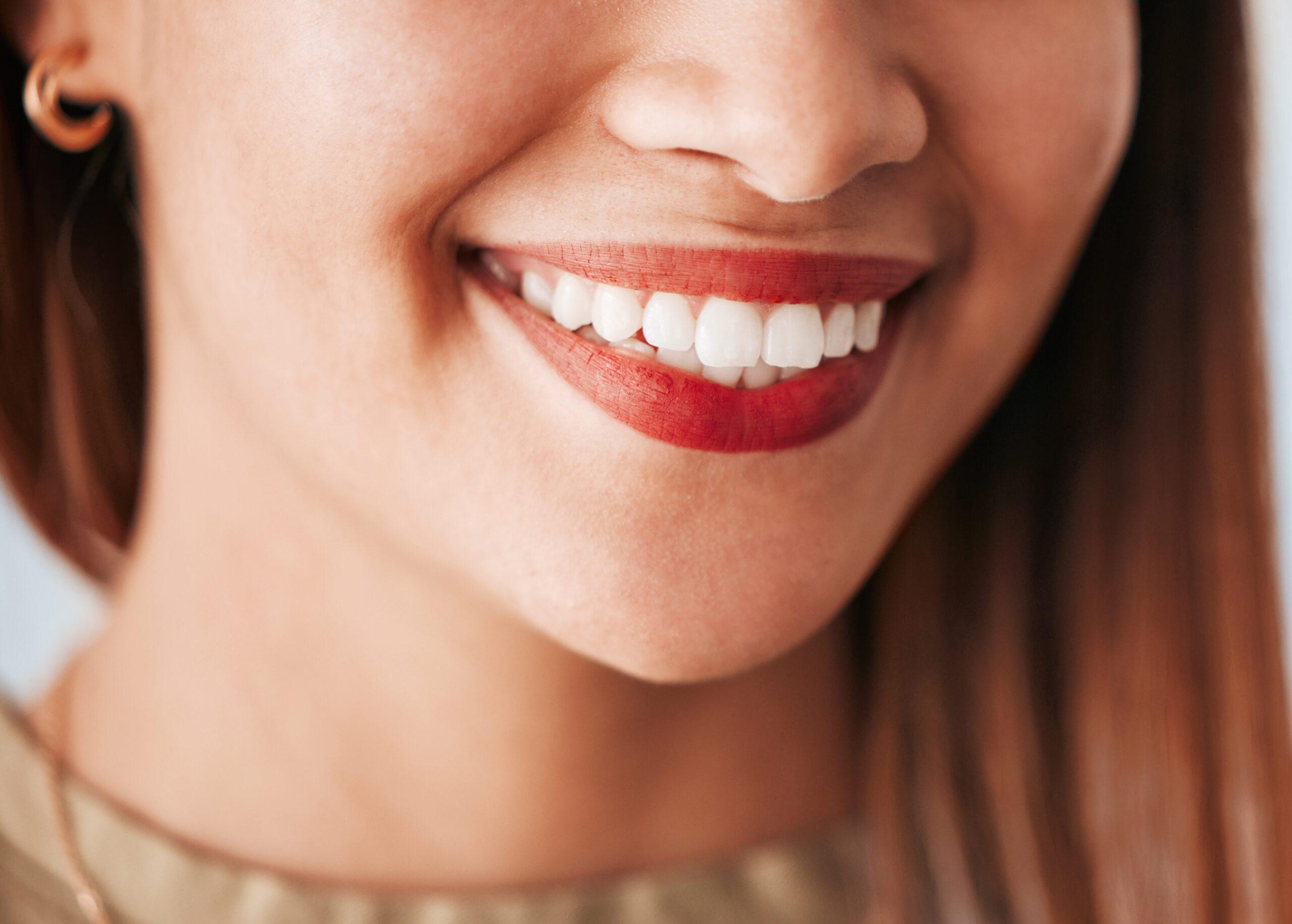 How Much Do Veneers Cost?