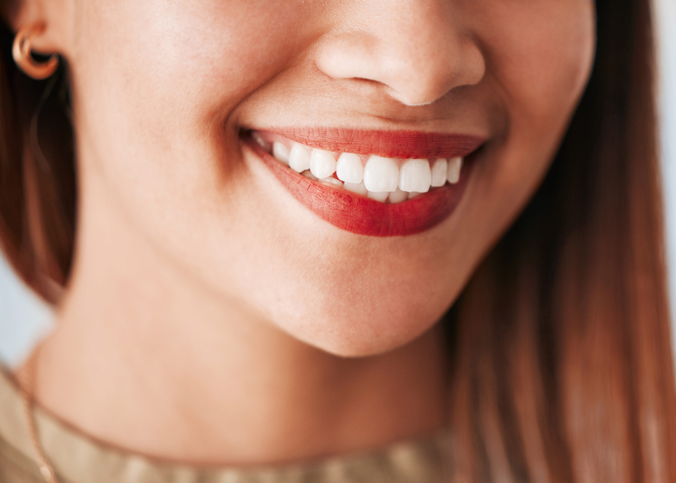 close up of woman with veneers
