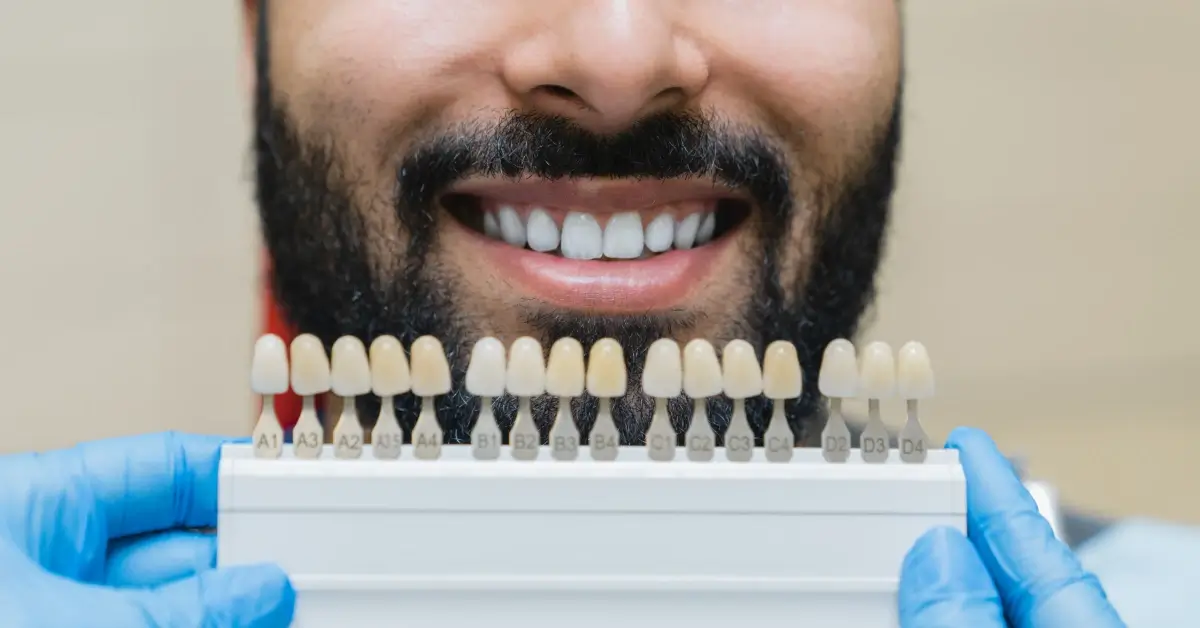 Porcelain Vs Composite Veneers: Which Are Better?