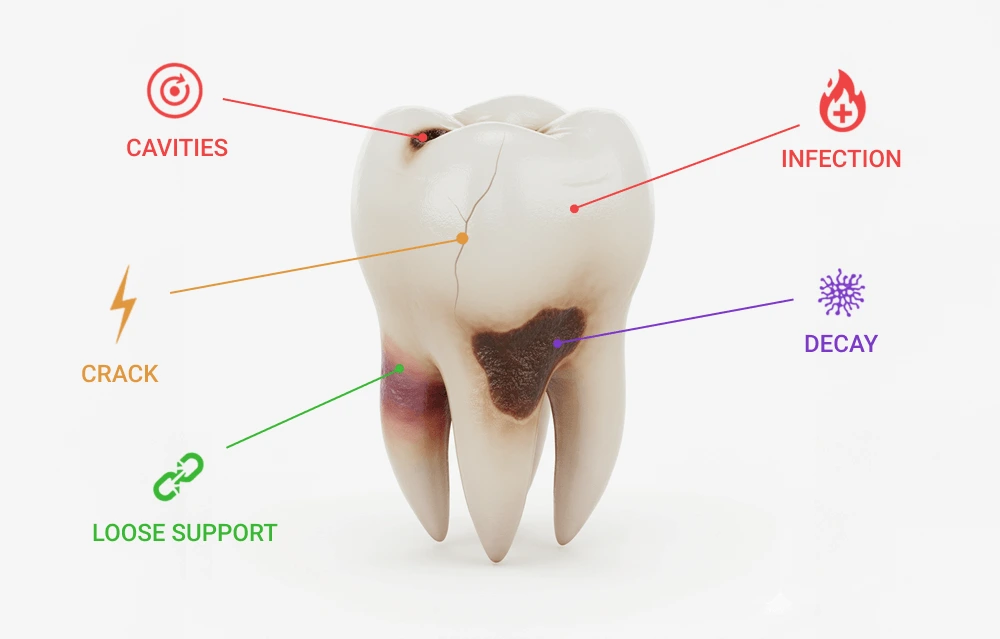 a diagram of a tooth