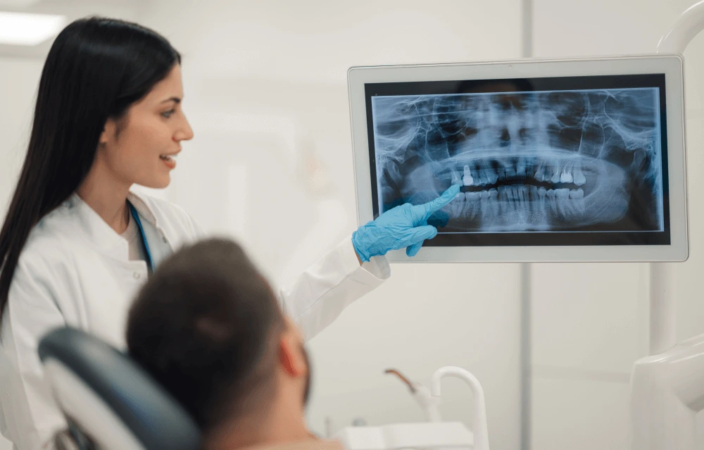 dental x-ray