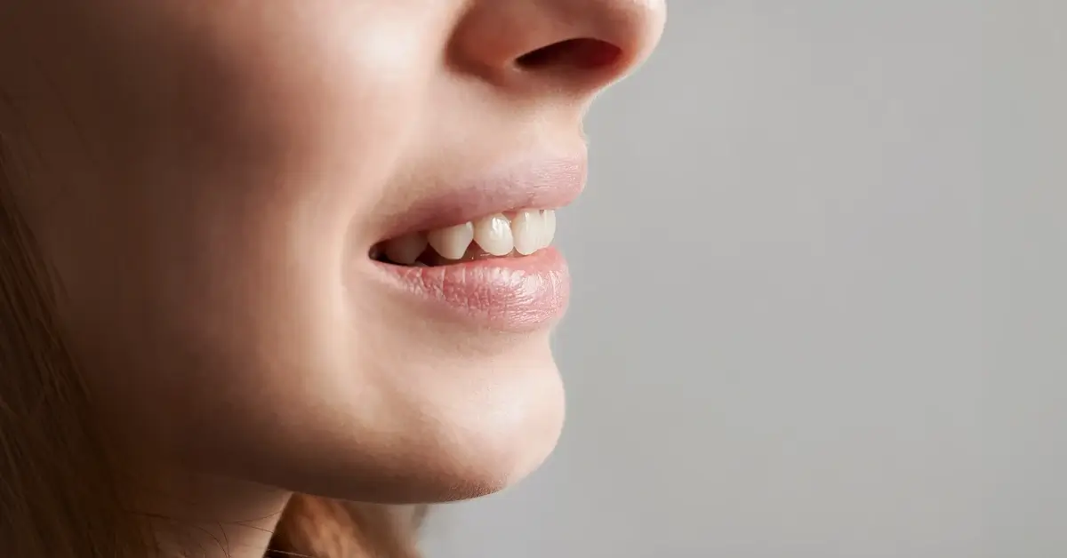 5 Things to Know Before You Choose Dental Bonding